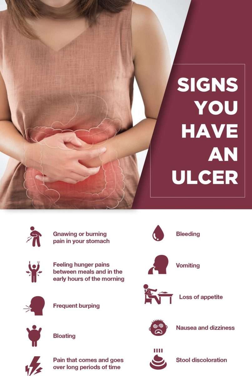 Get Your Ulcer Info Straight: Types, Causes, Symptoms, Treatments â The ...